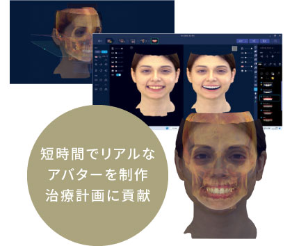 短時間でリアルなアバターを制作治療計画に貢献