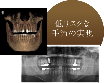 低リスクな手術の実現