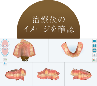 治療後のイメージを確認